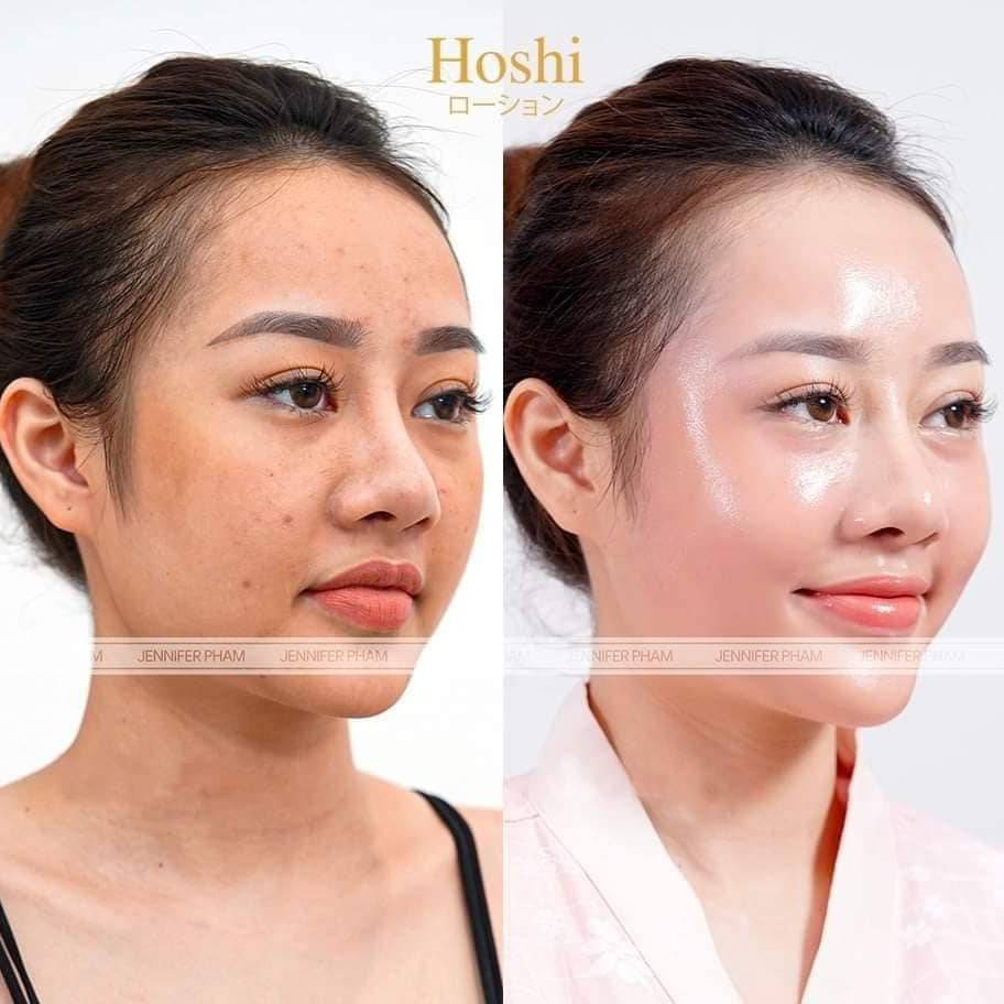 feedback về kem dưỡng da hoshi nhật bản- anh thư cosmetic