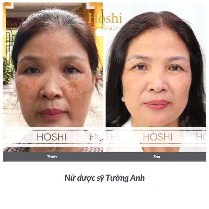 những khách hàng đã sử dụng kem dưỡng da hoshi nhật bản- anh thư cosmetic