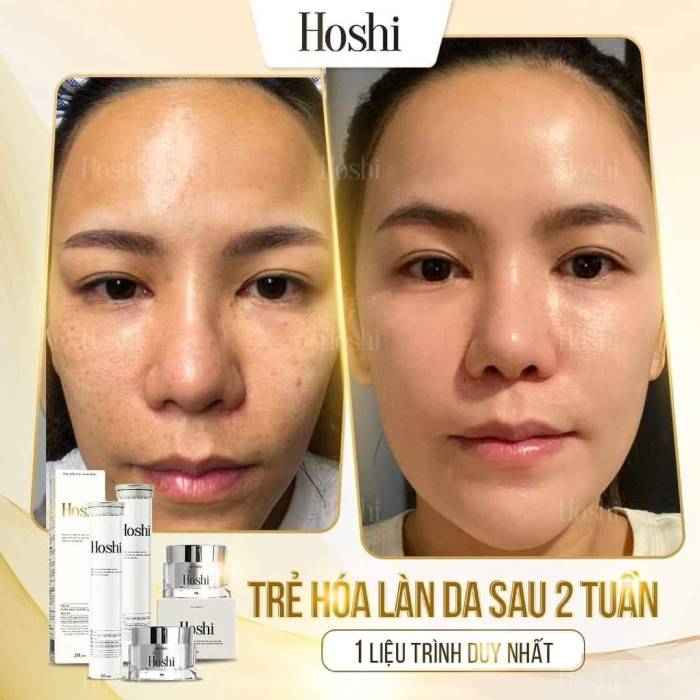 khách hàng đã sử dụng kem dưỡng da hoshi nhật bản- anh thư cosmetic