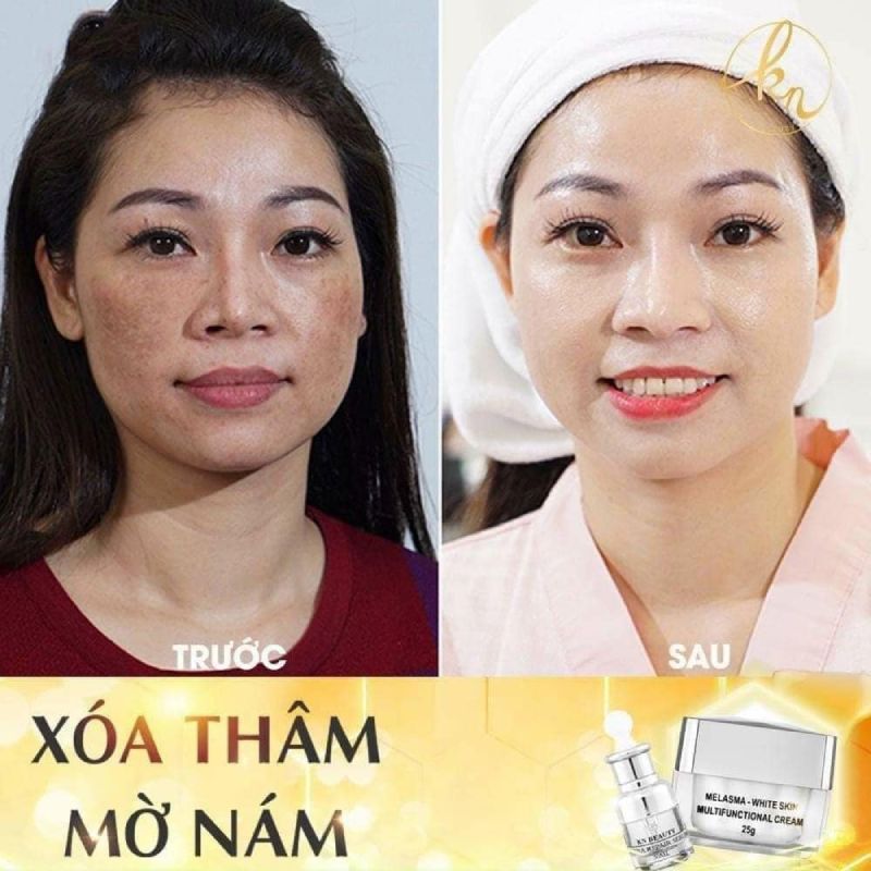 feedback của khách hàng khi sử dụng sản phẩm KN Beaauty -5-Hungthinhmart